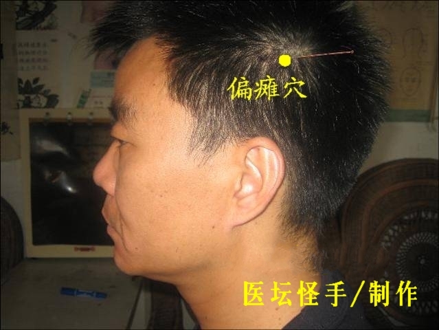 王文遠(yuǎn)平衡針灸穴位圖 - 3396815 - 3396815博愛(ài)