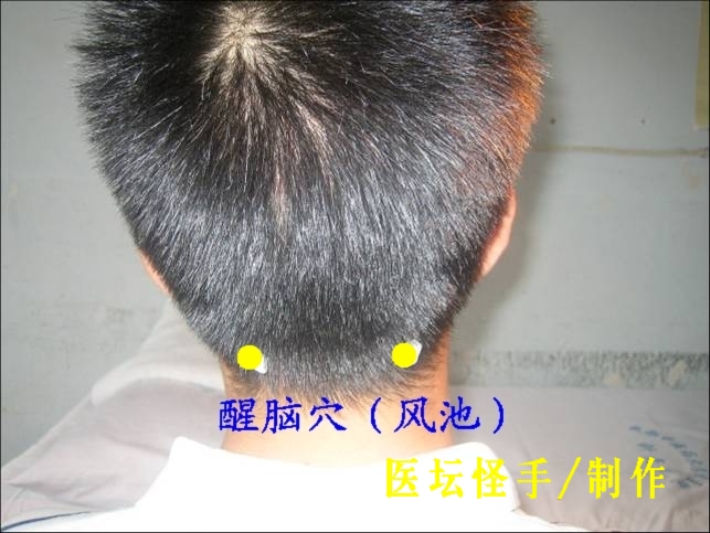 王文遠(yuǎn)平衡針灸穴位圖 - 3396815 - 3396815博愛(ài)