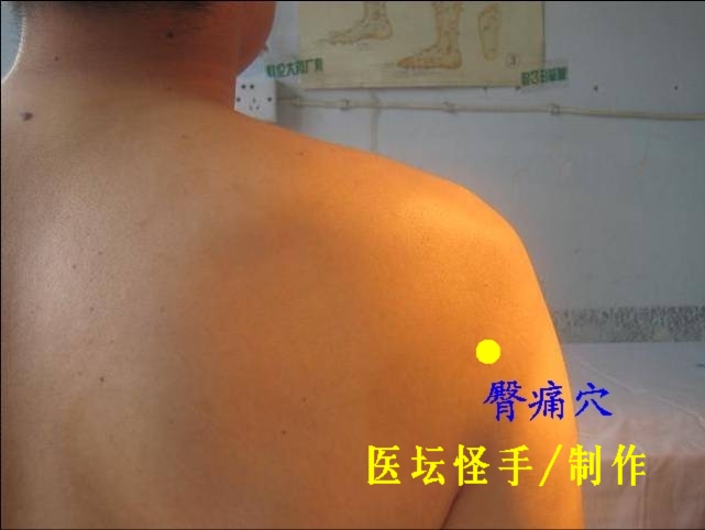 王文遠(yuǎn)平衡針灸穴位圖 - 3396815 - 3396815博愛(ài)