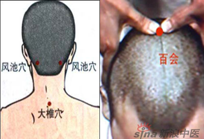 常見病艾灸時(shí)怎樣選穴？--大椎百會(huì)穴