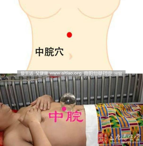 中脘穴位于腹部正中線，臍上4寸的位置上。每天艾灸10-15分鐘，能有效緩解胃部不適的癥狀，同時有助于祛濕。