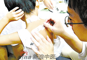 灸法的種類  你知道多少？